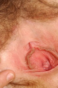Hairy Babe